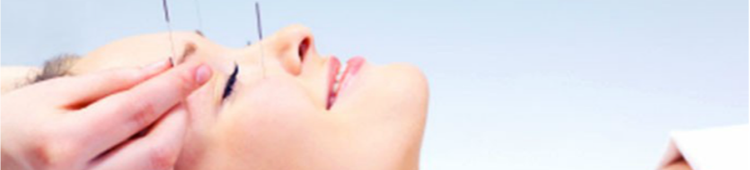 woman receiving anti aging acupuncture face lift in kelowna